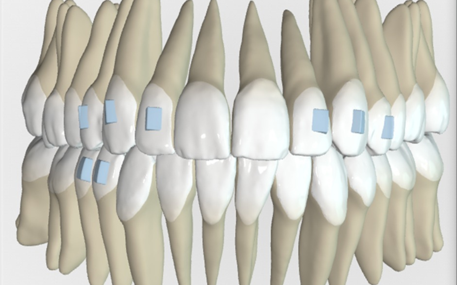 imagen laser3