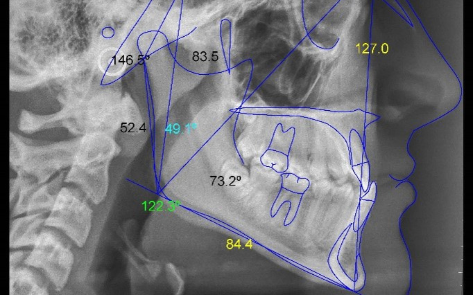 imagen laser1